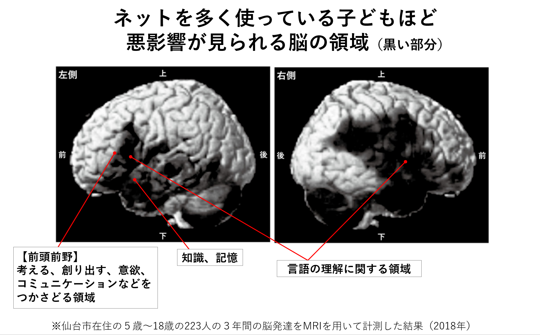 スマホ脳 スマホ使いすぎると「勉強が台なしに」 脳トレ・川島隆太教授がデータ