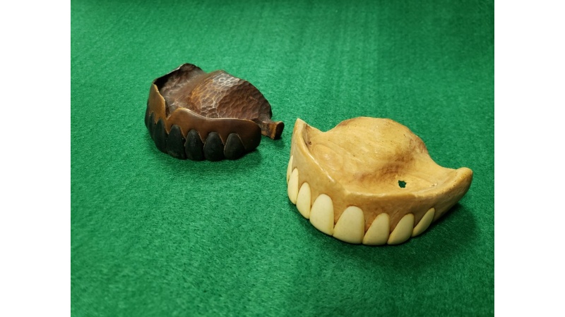 写真】18世紀の入れ歯ってどんなもの？ 歯を抜く浮世絵など、「医の